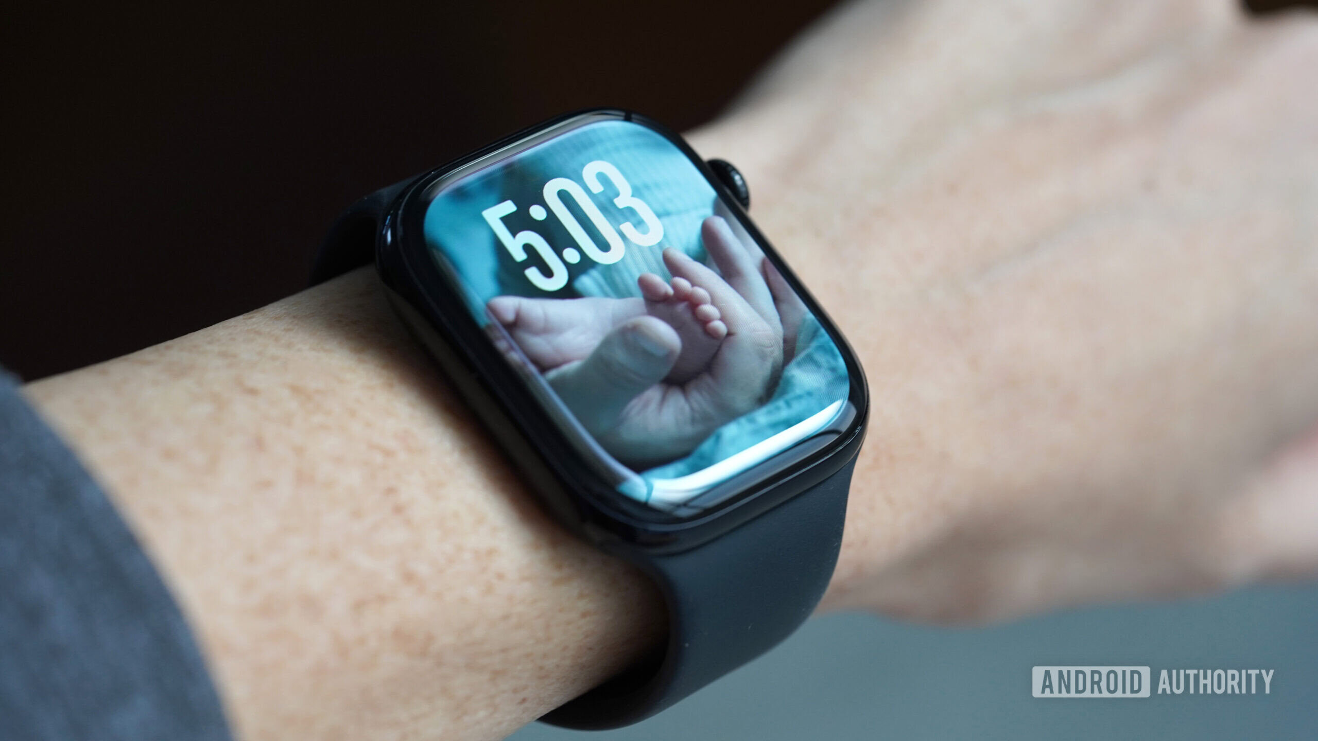 Apple Watch Photo Face A user's Apple Watch displays a photo watch face.